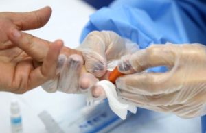 Brasil monitora 28 casos suspeitos de hepatite de causa desconhecida Doença acomete crianças em sete estados brasileiros. (Foto: Saúde RJ/Divulgação)